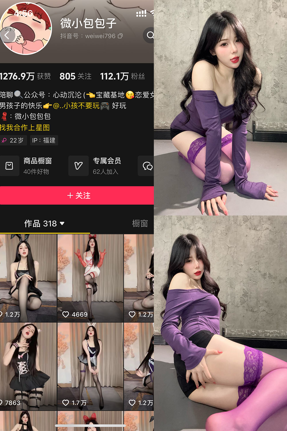 抖音博主 微小包包子 微密圈作品  NO.008期 【26P1V】最新至：2025.3.15